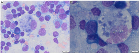 Salmon poisoning disease in dogs: clinical presentation, diagnosis and treatment.