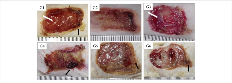 Treatment of experimentally induced partial-thickness burns in rats with different silver-impregnated dressings.