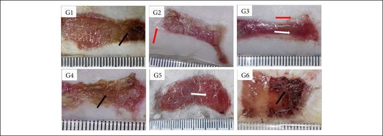 Treatment of experimentally induced partial-thickness burns in rats with different silver-impregnated dressings.