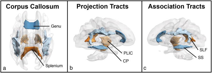 Fiber Ball white matter modeling reveals microstructural alterations in healthy brain aging