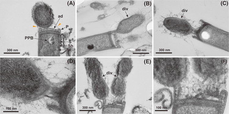 Novel Cross-domain Symbiosis between Candidatus Patescibacteria and Hydrogenotrophic Methanogenic Archaea Methanospirillum Discovered in a Methanogenic Ecosystem.