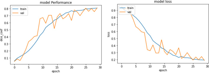 A low resource 3D U-Net based deep learning model for medical image analysis.