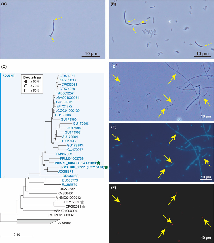 Novel Cross-domain Symbiosis between Candidatus Patescibacteria and Hydrogenotrophic Methanogenic Archaea Methanospirillum Discovered in a Methanogenic Ecosystem.