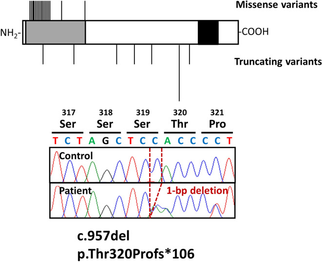 A patient with congenital hypothyroidism due to a <i>PAX8</i> frameshift variant accompanying a urogenital malformation.