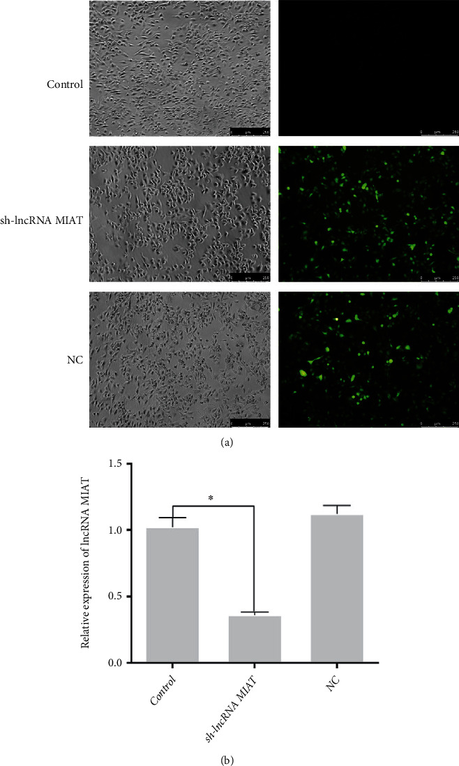 LncRNA MIAT Upregulates NEGR1 by Competing for miR-150-5p as a Competitive Endogenous RNA in SCIRI Rats.