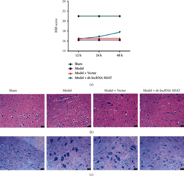 LncRNA MIAT Upregulates NEGR1 by Competing for miR-150-5p as a Competitive Endogenous RNA in SCIRI Rats.