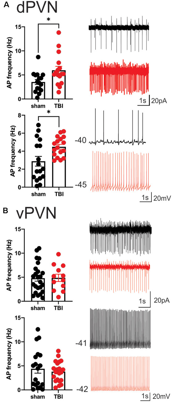 Blast-Induced Mild Traumatic Brain Injury Alterations of Corticotropin-Releasing Factor Neuronal Activity in the Mouse Hypothalamic Paraventricular Nucleus.