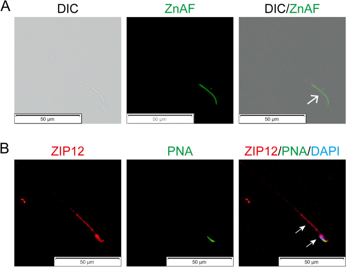 Zinc transporter ZIP12 maintains zinc homeostasis and protects spermatogonia from oxidative stress during spermatogenesis.