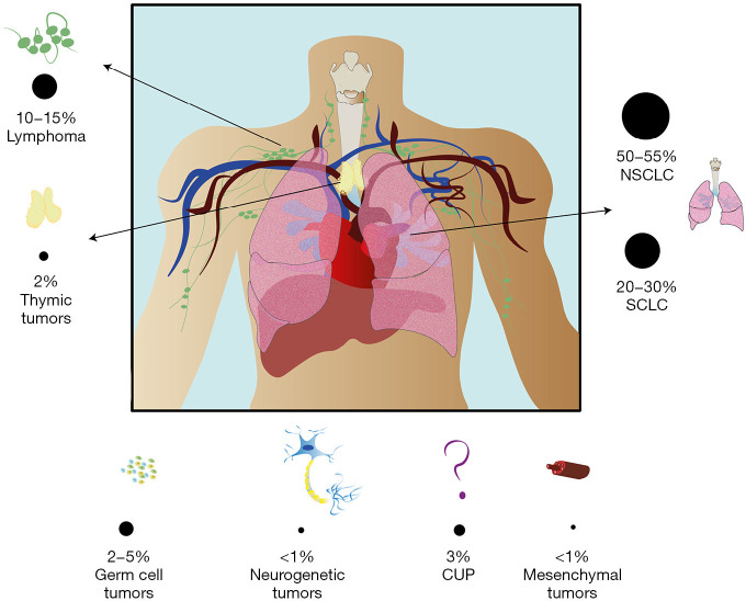 Principles of medical and oncological management of giant masses of the mediastinum: a narrative review.