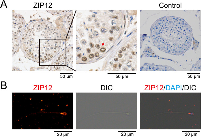Zinc transporter ZIP12 maintains zinc homeostasis and protects spermatogonia from oxidative stress during spermatogenesis.