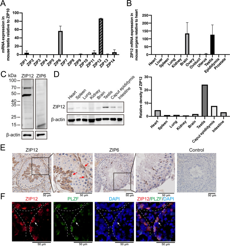 Zinc transporter ZIP12 maintains zinc homeostasis and protects spermatogonia from oxidative stress during spermatogenesis.