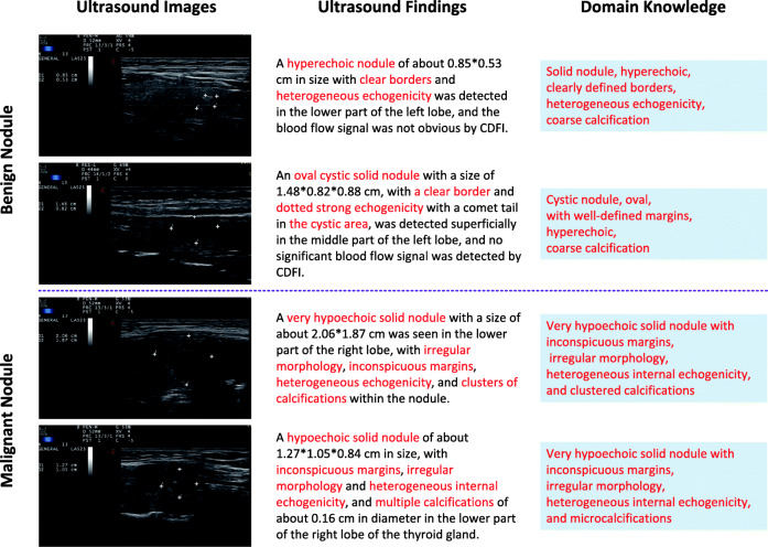 Semantic consistency generative adversarial network for cross-modality domain adaptation in ultrasound thyroid nodule classification