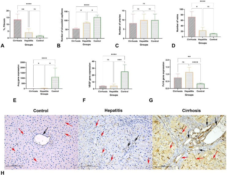 FN14 mRNA Expression Correlates with an Increased Number of Veins during Angiogenesis in the Process of Liver Fibrosis.