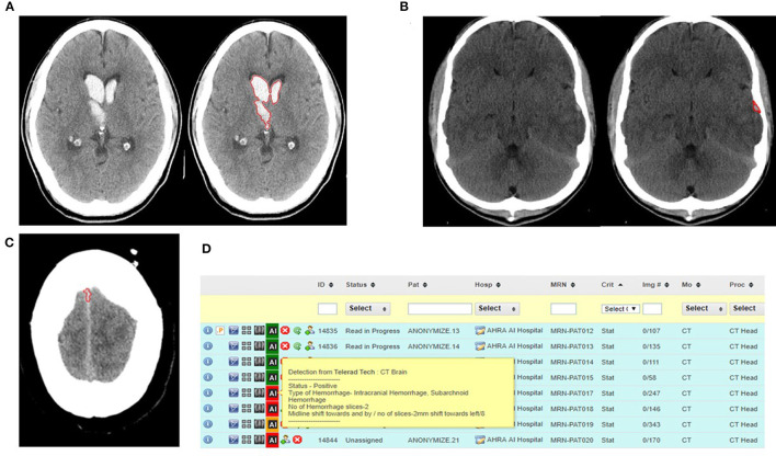 Emergency Teleradiology-Past, Present, and, Is There a Future?