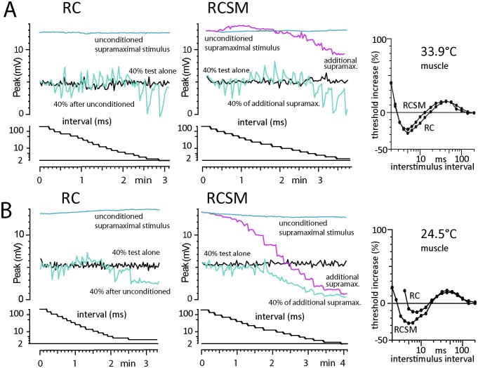 A test to determine the site of abnormal neuromuscular refractoriness