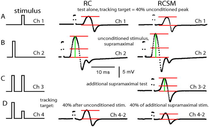 A test to determine the site of abnormal neuromuscular refractoriness