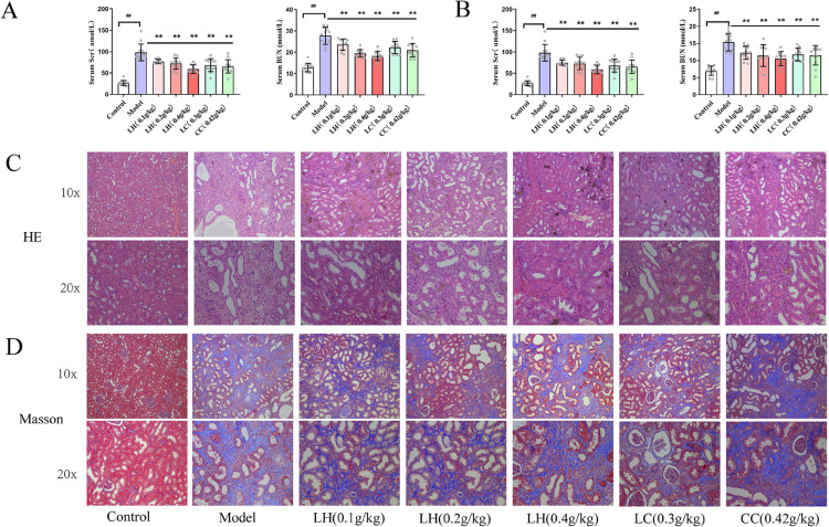 Metabolomics of clinical samples reveal the treatment mechanism of lanthanum hydroxide on vascular calcification in chronic kidney disease.