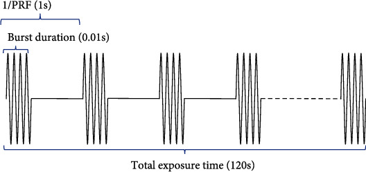 Treatment Combining Focused Ultrasound with Gastrodin Alleviates Memory Deficit and Neuropathology in an Alzheimer's Disease-Like Experimental Mouse Model.