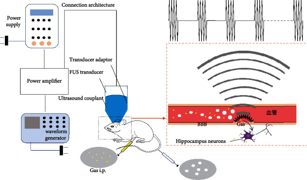 Treatment Combining Focused Ultrasound with Gastrodin Alleviates Memory Deficit and Neuropathology in an Alzheimer's Disease-Like Experimental Mouse Model.