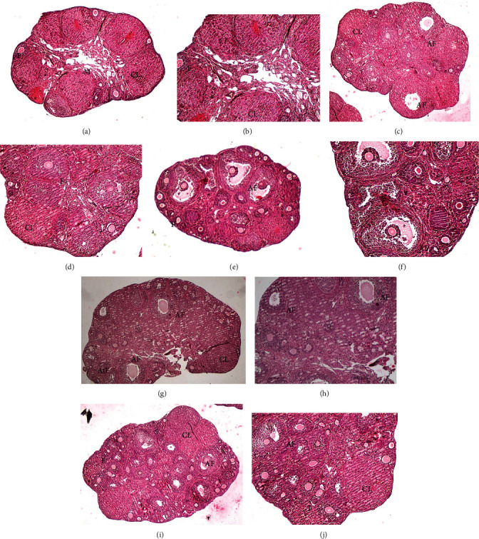 Serum Scavenging Capacity and Folliculogenesis Impact following Flaxseed Consumption in the First-Generation Mice Pups.