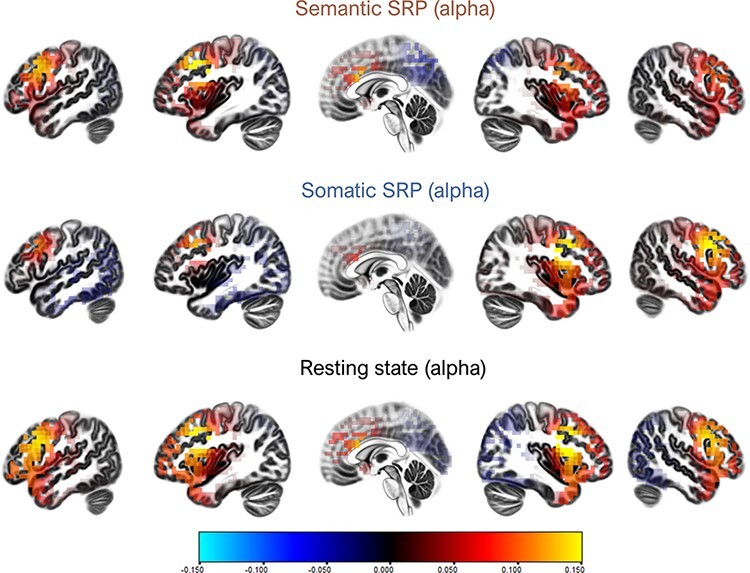 Sense of self in mind and body: an eLORETA-EEG study.