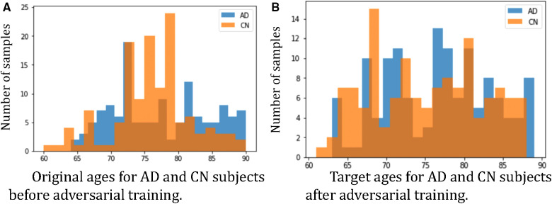 Adversarial counterfactual augmentation: application in Alzheimer's disease classification.