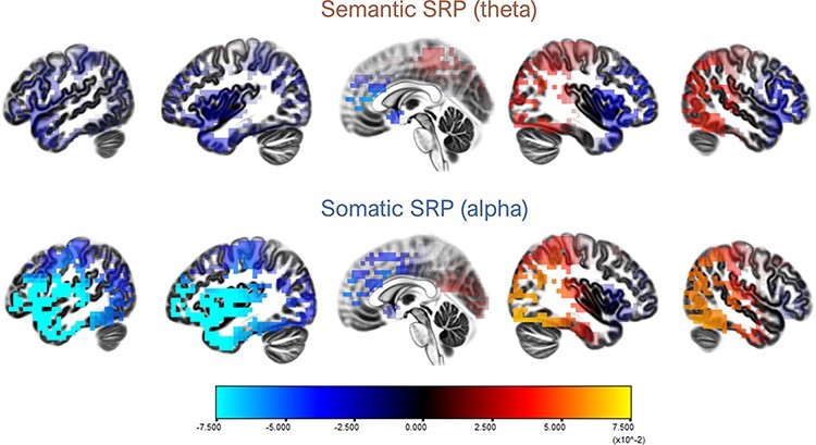 Sense of self in mind and body: an eLORETA-EEG study.