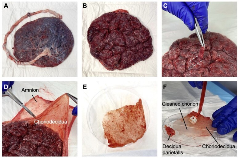 Isolation of single cells from human uterus in the third trimester of pregnancy: myometrium, decidua, amnion and chorion.