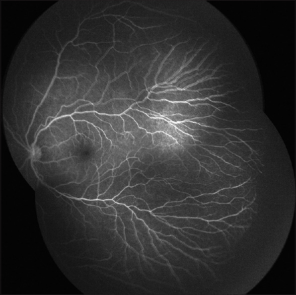 Multimodal Imaging, Tele-Education, and Telemedicine in Retinopathy of Prematurity.