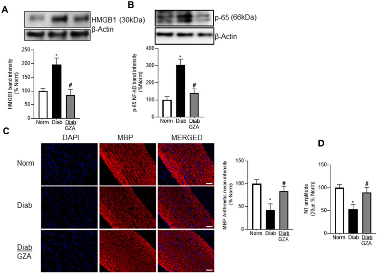 Involvement of High Mobility Group Box 1 Protein in Optic Nerve Damage in Diabetes.