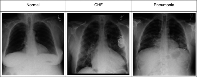 Improving disease classification performance and explainability of deep learning models in radiology with heatmap generators.