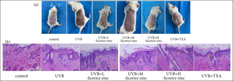 Licorice zinc suppresses melanogenesis via inhibiting the activation of P38MAPK and JNK signaling pathway in C57BL/6J mice skin.