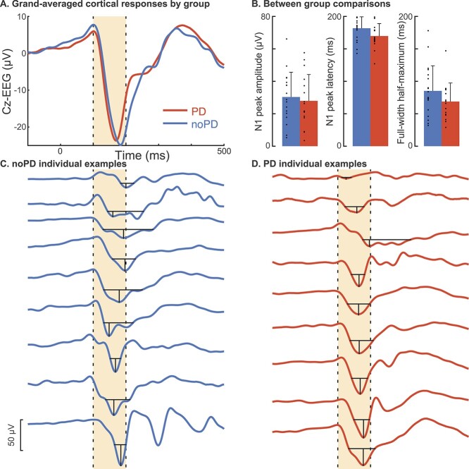 The cortical N1 response to balance perturbation is associated with balance and cognitive function in different ways between older adults with and without Parkinson's disease.