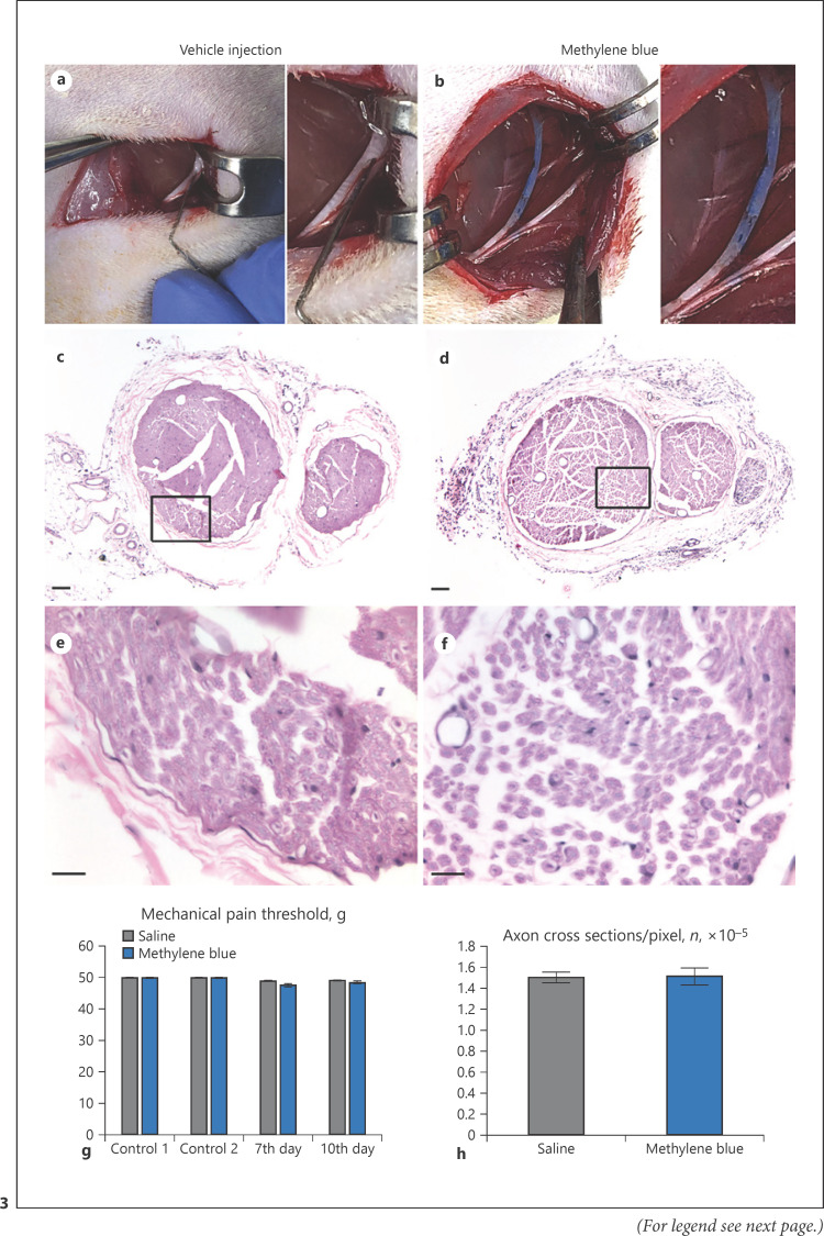 Epineural Methylene Blue Injection May Aid Localization of Digital Nerves in Dupuytren's Surgery.