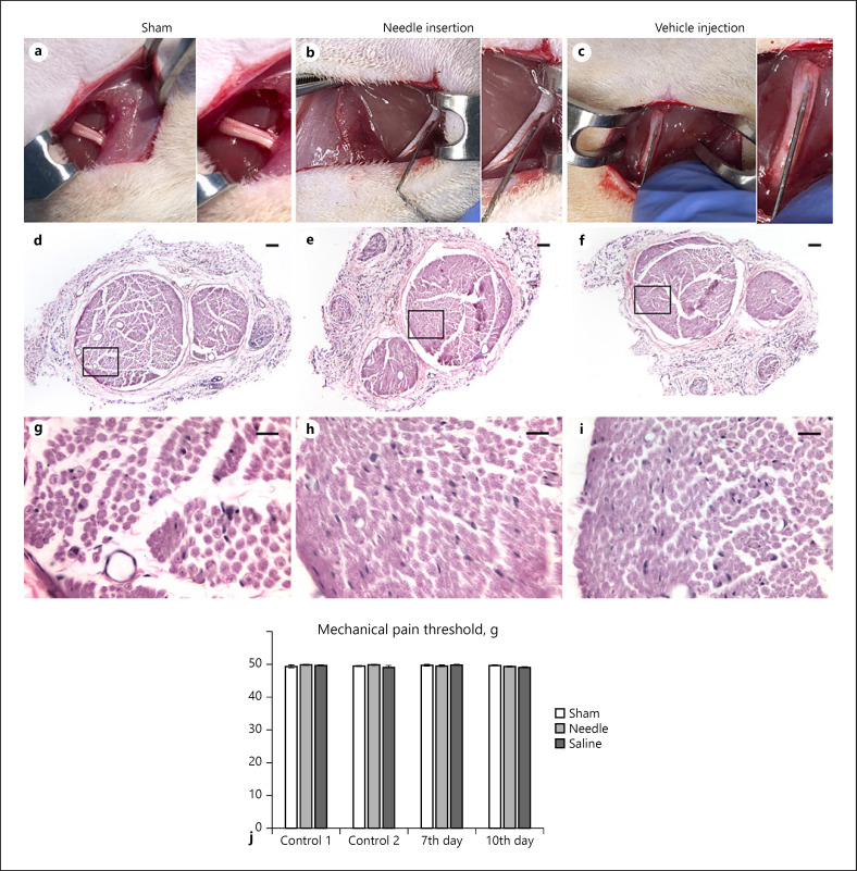 Epineural Methylene Blue Injection May Aid Localization of Digital Nerves in Dupuytren's Surgery.