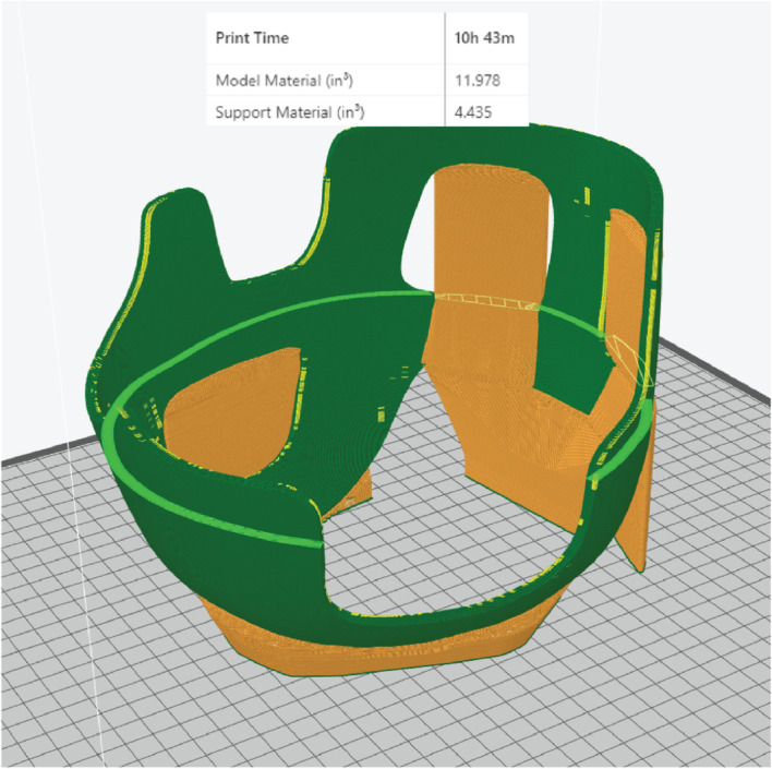 Patient-specific 3D-printed helmet for post-craniectomy defect - a case report.