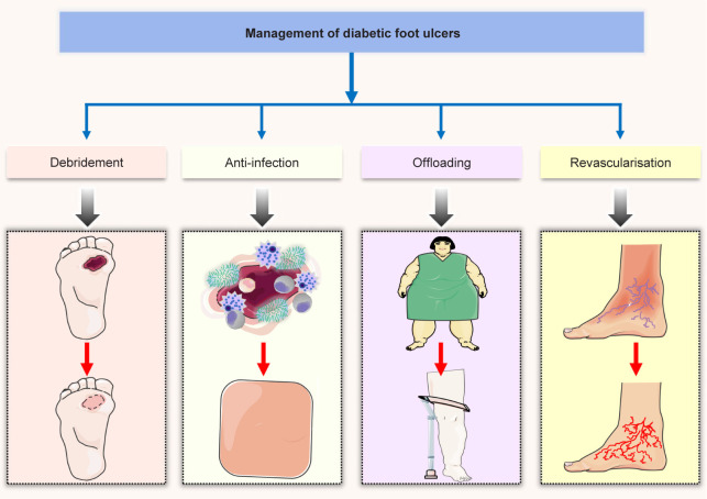 Advances and perspective on animal models and hydrogel biomaterials for diabetic wound healing.