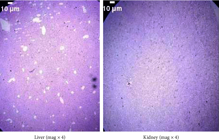 Acute and Subacute Toxicity Study of Essential Oil of Cymbopogon Martini in Mice.