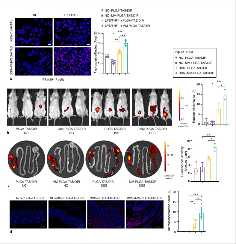 Macrophage-Biomimetic Nanoparticles Ameliorate Ulcerative Colitis through Reducing Inflammatory Factors Expression.