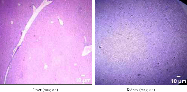 Acute and Subacute Toxicity Study of Essential Oil of Cymbopogon Martini in Mice.