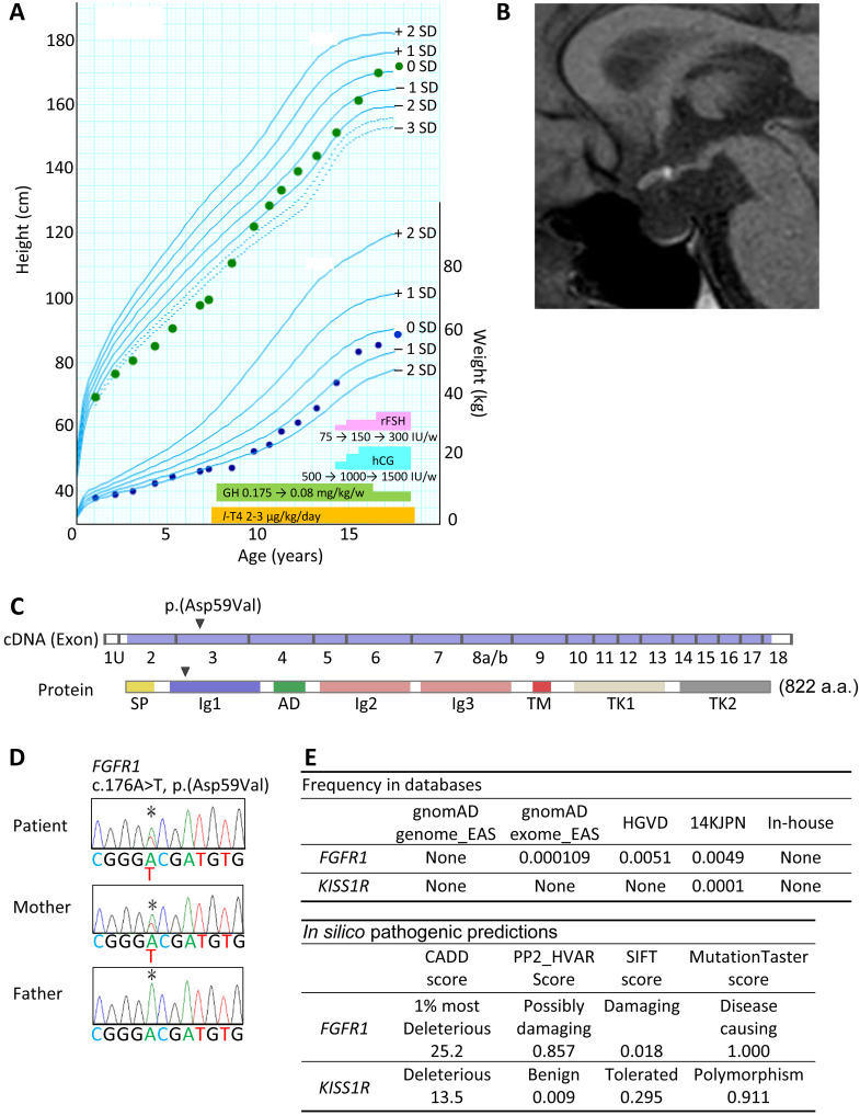 Combined pituitary hormone deficiency in a patient with an <i>FGFR1</i> missense variant: case report and literature review.