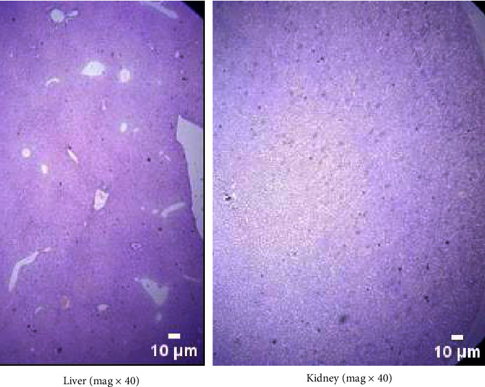 Acute and Subacute Toxicity Study of Essential Oil of Cymbopogon Martini in Mice.