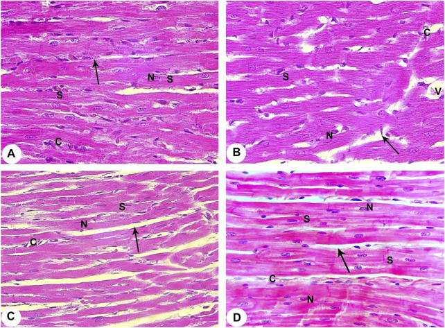 Intermittent Short-Duration Re-oxygenation Attenuates Cardiac Changes in Response to Hypoxia: Histological, Ultrastructural and Oxidant/Antioxidant Parameters.