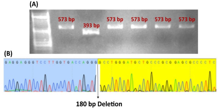 A Decrease in CD44 on Cell Surfaces (MKN-45 cell line) After RELA Knockout Using CRISPR/Cas9.