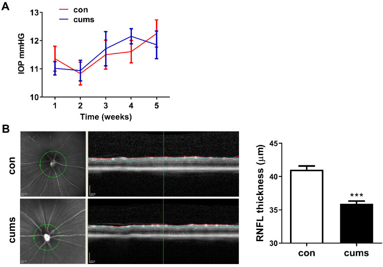 Psychological stress induces moderate pathology in the ganglion cell layer in mice.