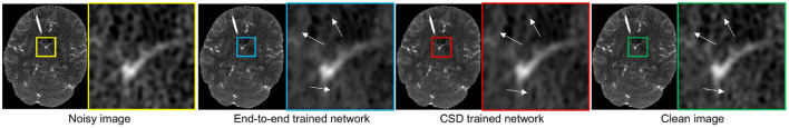 PIMA-CT: Physical Model-Aware Cyclic Simulation and Denoising for Ultra-Low-Dose CT Restoration.