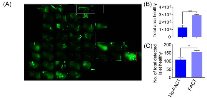 Enhanced characterization of beta cell mass in a Tg(<i>Pdx1-GFP</i>) mouse model.