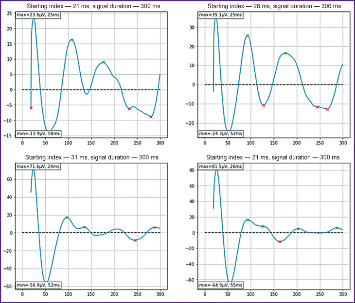 Prediction of Postoperative Speech Dysfunctions in Neurosurgery Based on Cortico-Cortical Evoked Potentials and Machine Learning Technology.