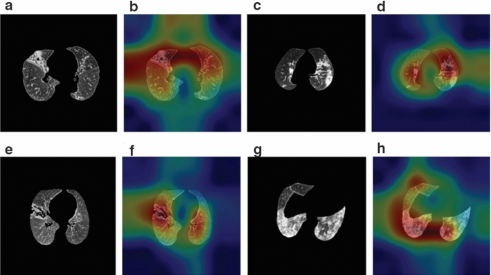 Using artificial intelligence technology to fight COVID-19: a review