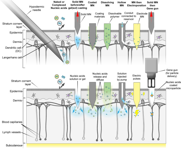 Microneedle systems for delivering nucleic acid drugs.